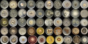 Bacteria growing in petri dishes